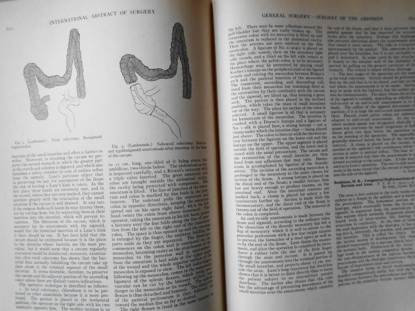International Abstract Of Surgery -- Vol. 19, July To December, 1914