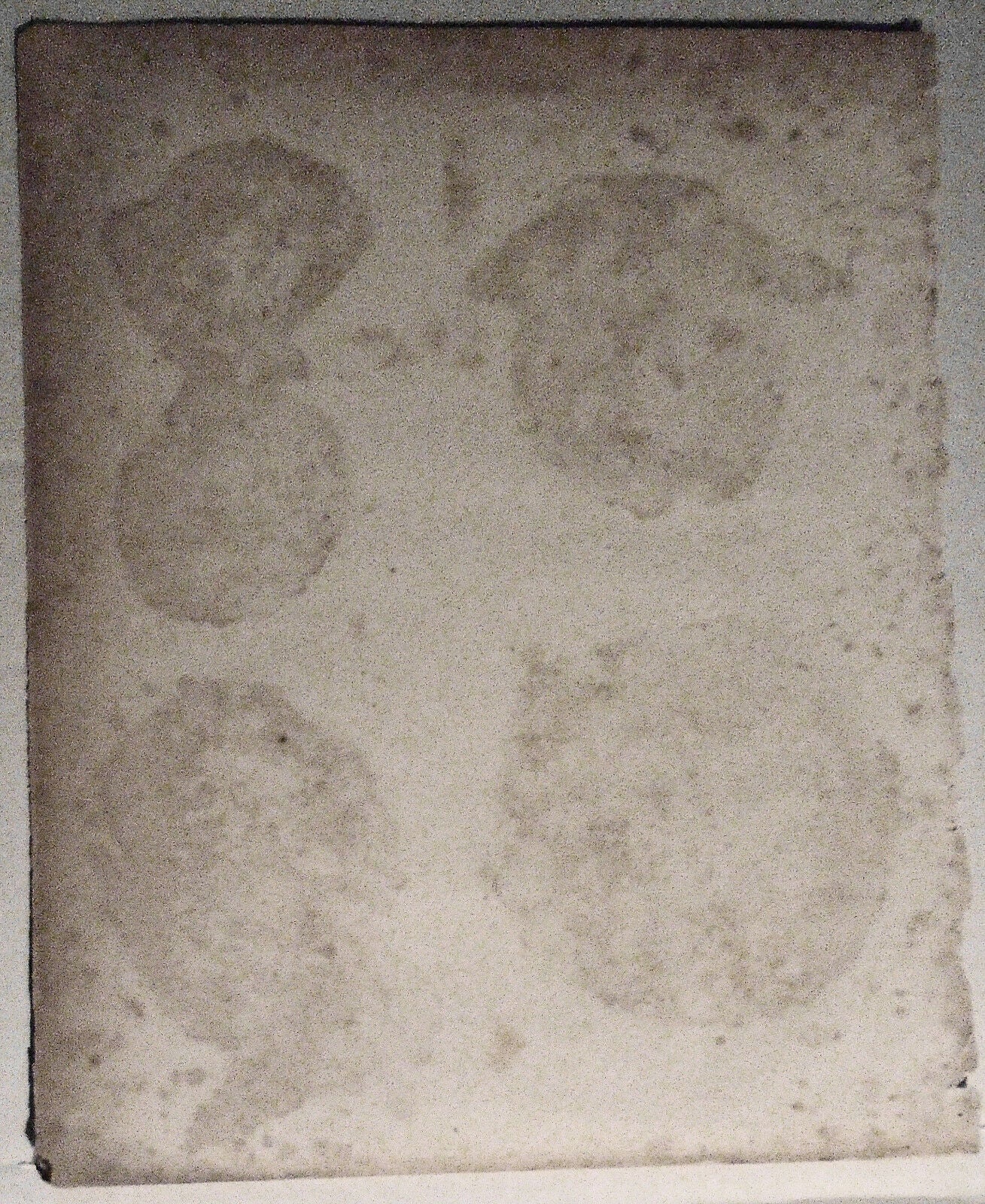 MIDWIFERY - engraved plate from Rees' Cyclopaedia, published 1802-1820