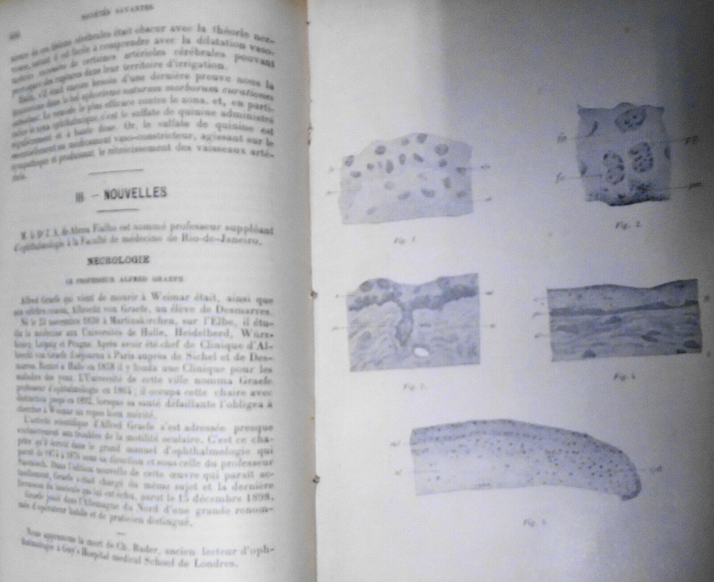 Annales D'Oculistique 1899. Bound Vol. 121/122. Yearly Ophthalmological Journal