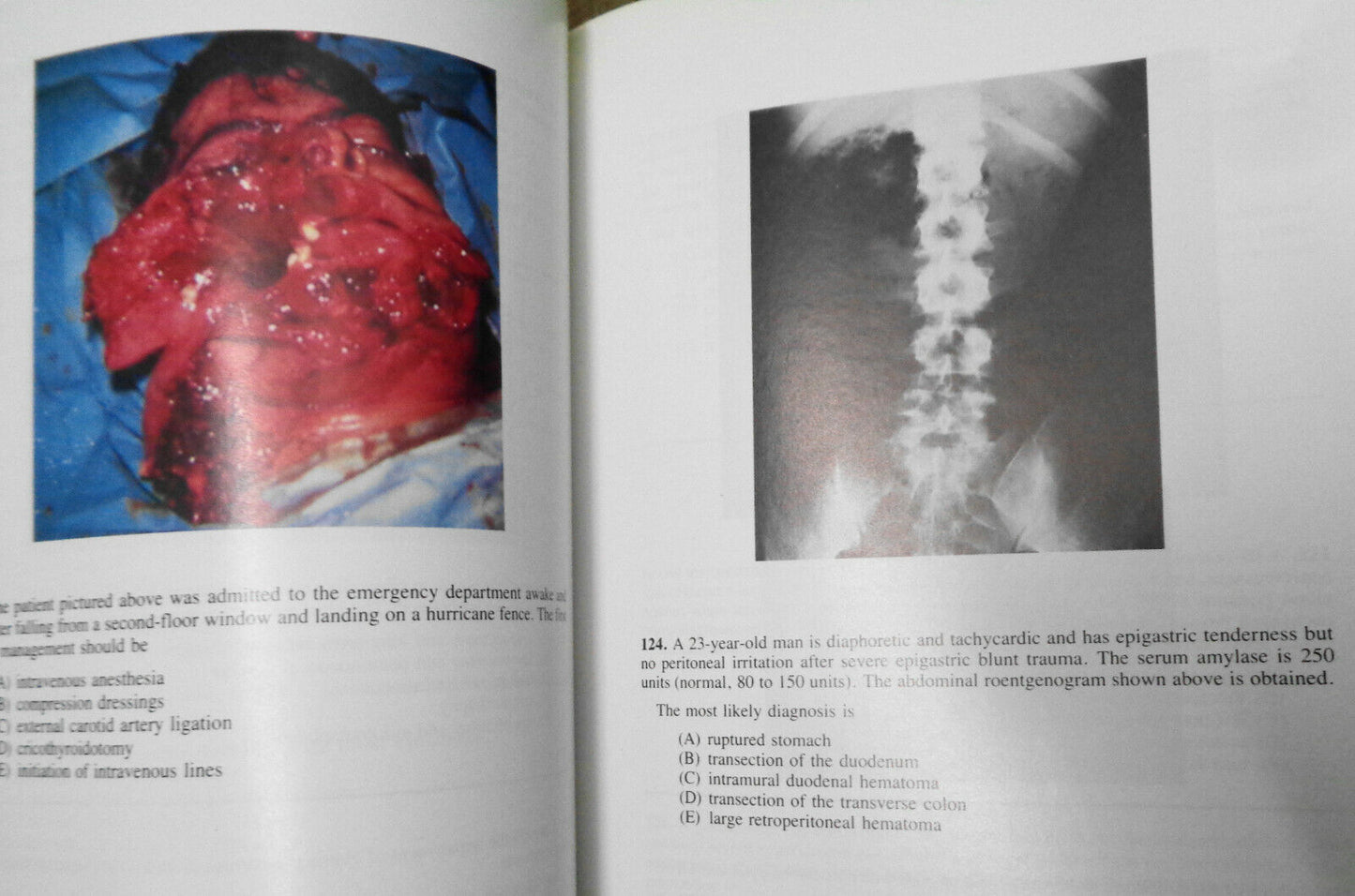 American College of Surgeons, SESAP V Syllabus. 1985.