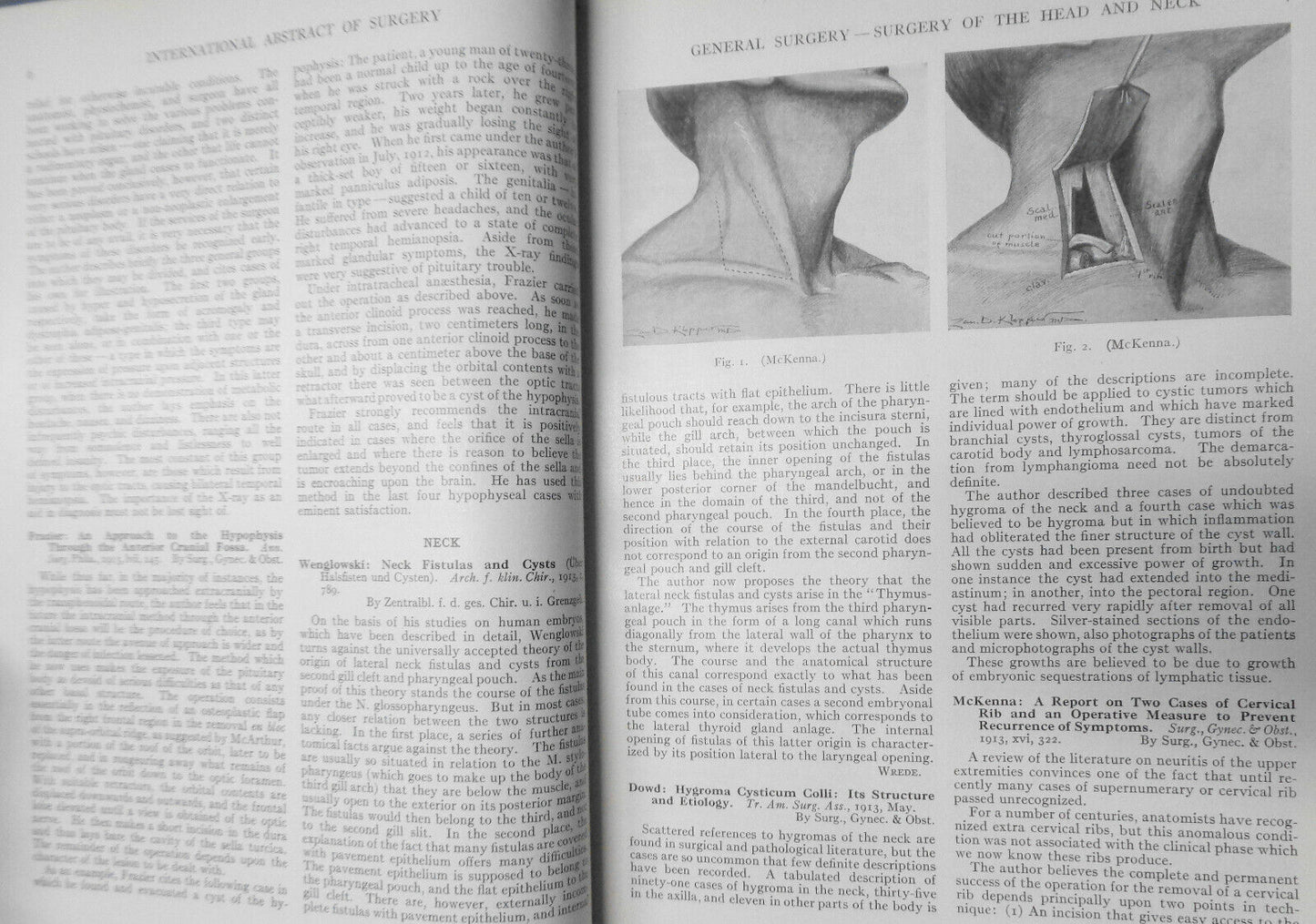 INTERNATIONAL ABSTRACT OF SURGERY ... VOL. 17, JULY TO DEC, 1913