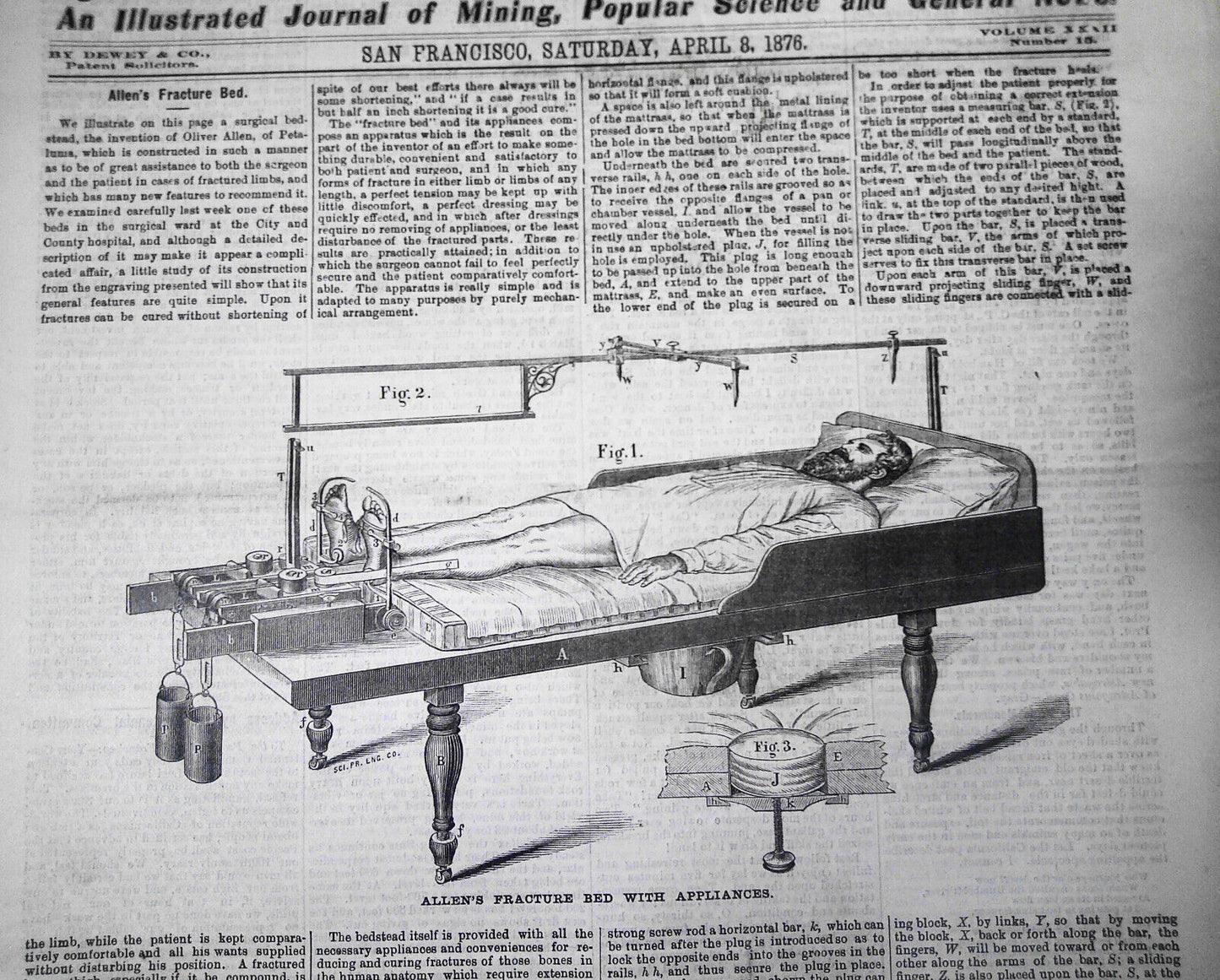 Mining and Scientific Press, April 8, 1876. Allen's Fracture Bed; etc