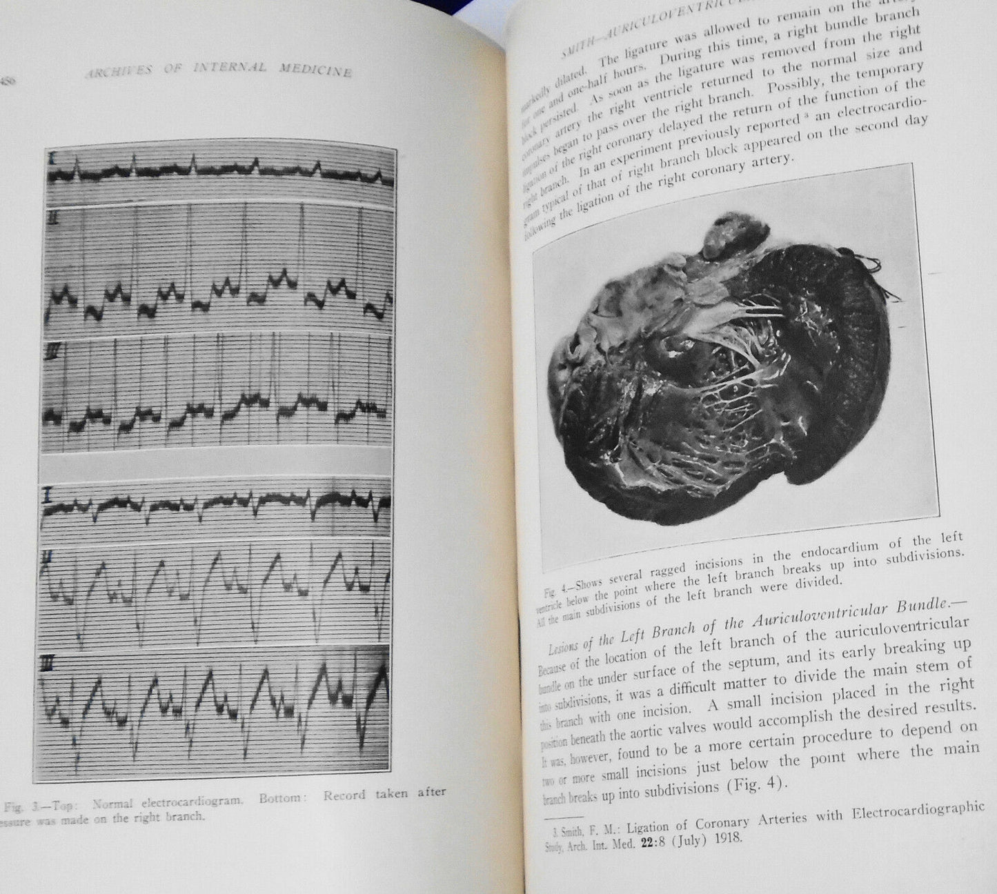 Archives Of Internal Medicine, Volume 28, 1921