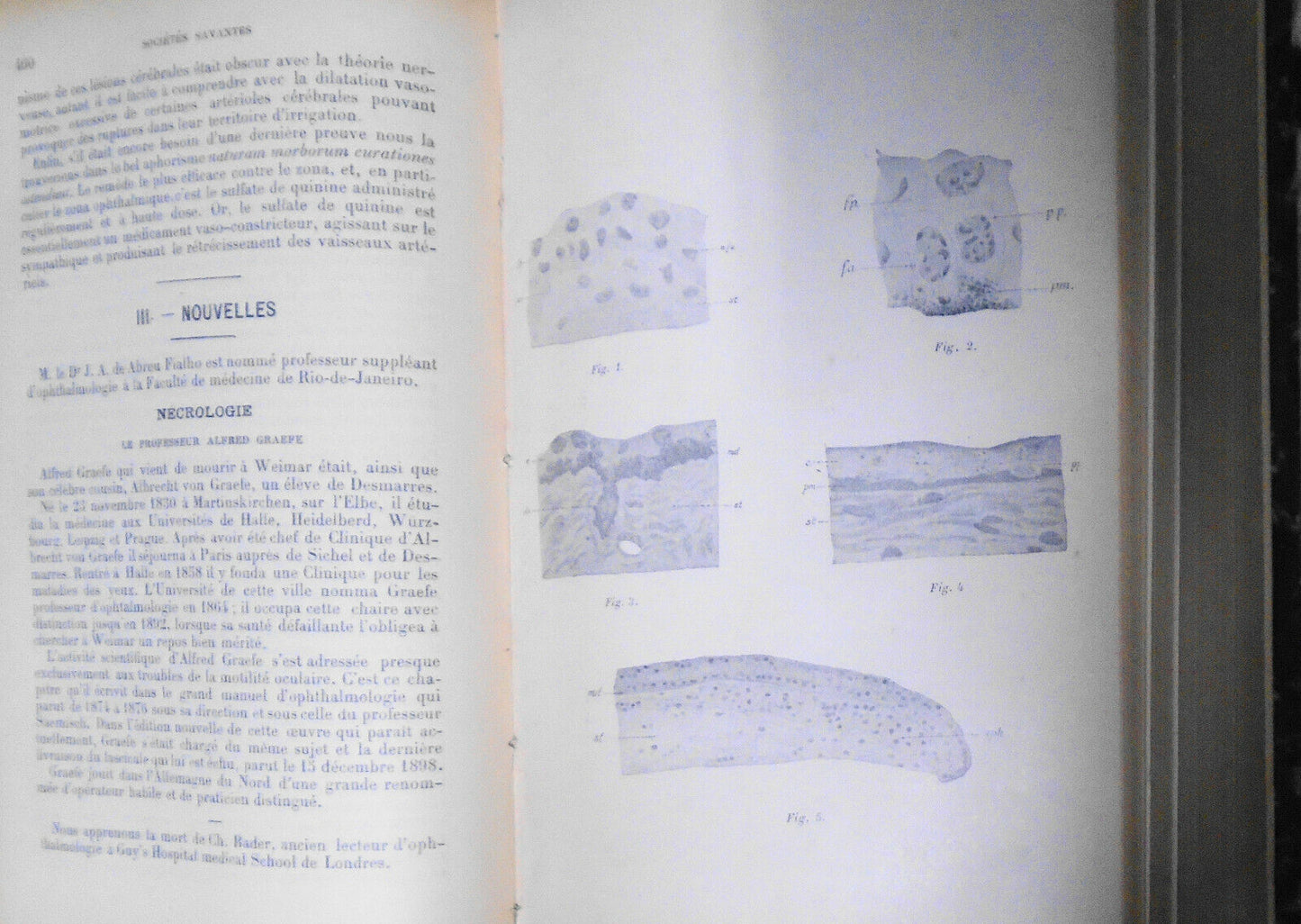 Annales D'Oculistique 1899. Bound Vol. 121/122. Yearly Ophthalmological Journal