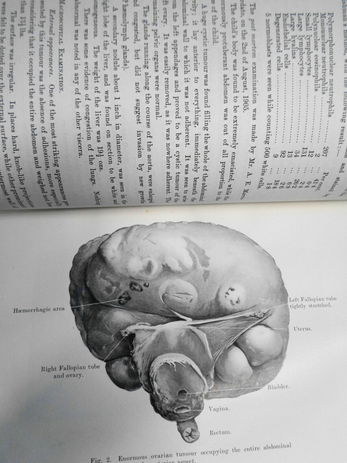 Journal Of Obstetrics And Gynaecology - Vol. IX. Jan To June, 1906