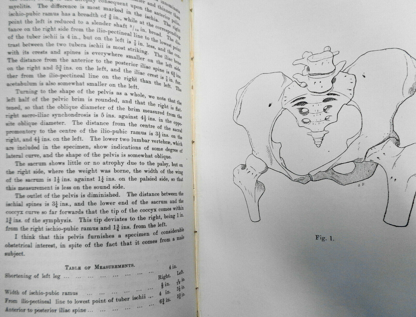 JOURNAL OF OBSTETRICS AND GYNAECOLOGY - VOL. IX. JAN TO JUNE, 1906