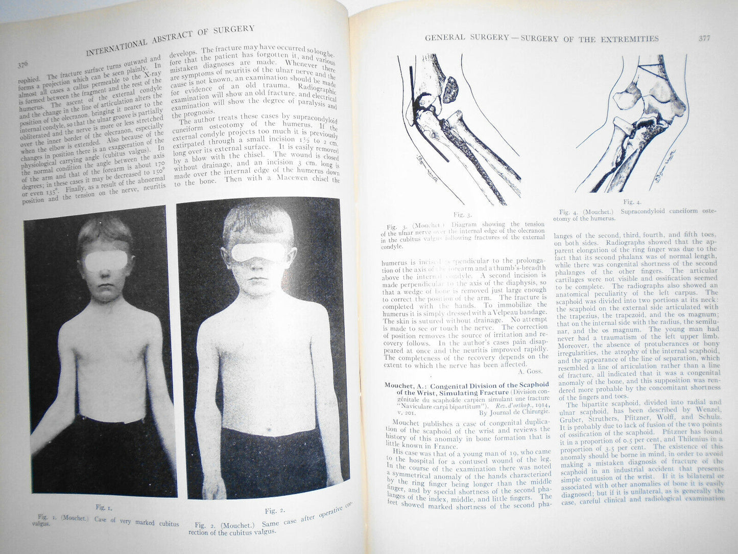 International Abstract Of Surgery --  Vol. 19, July To December, 1914