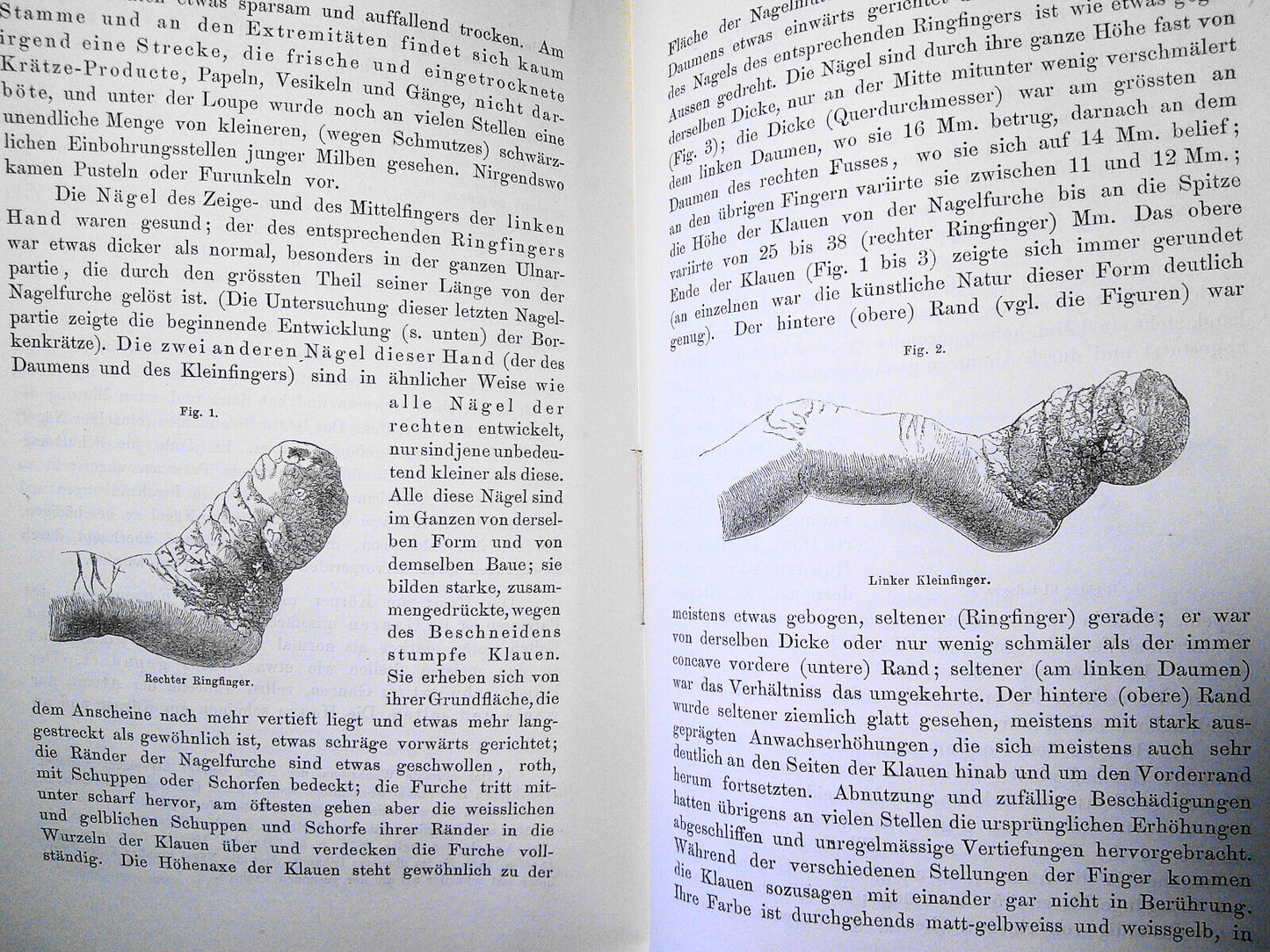 Vierteljahresschrift Fur Dermatologie Und Syphilis. I  Jahrang 1874 Viertes Heft