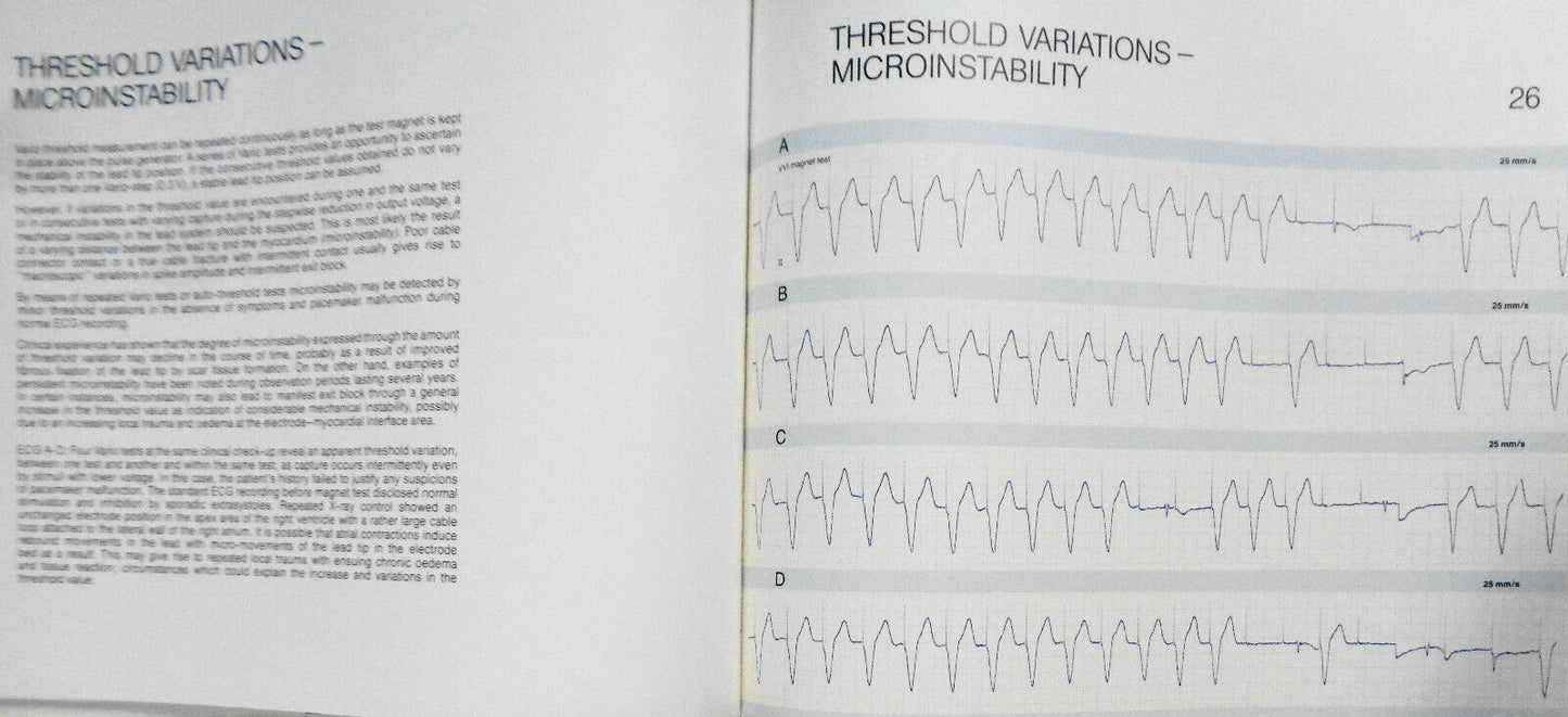 Pacemaker electrocardiograms : an introduction to practical analysis - SIGNED