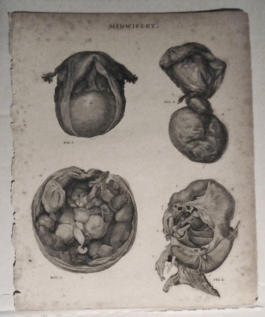 MIDWIFERY - engraved plate from Rees' Cyclopaedia, published 1802-1820