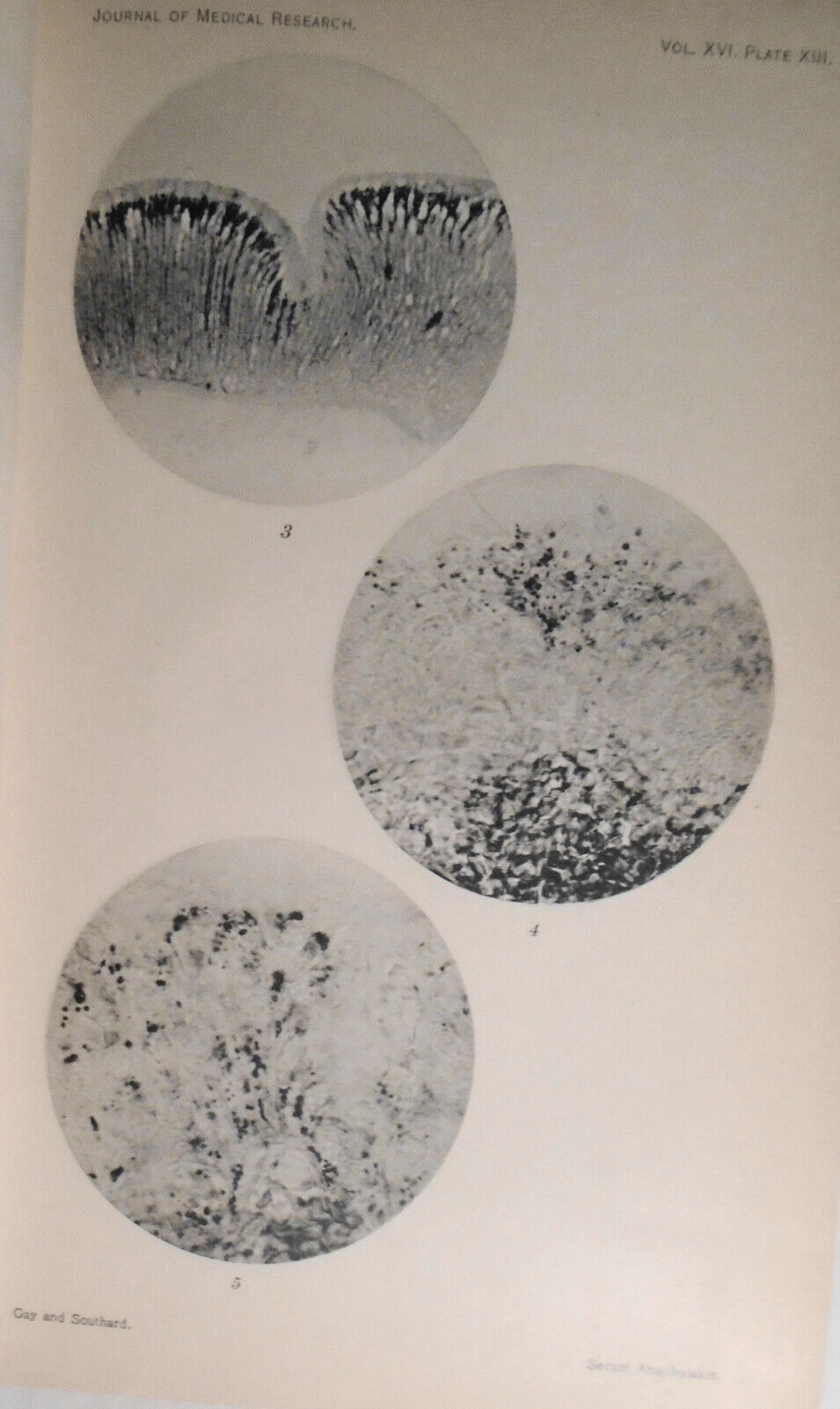 Studies From the Rockefeller Institute for Medical Research - Volume 3, 1905