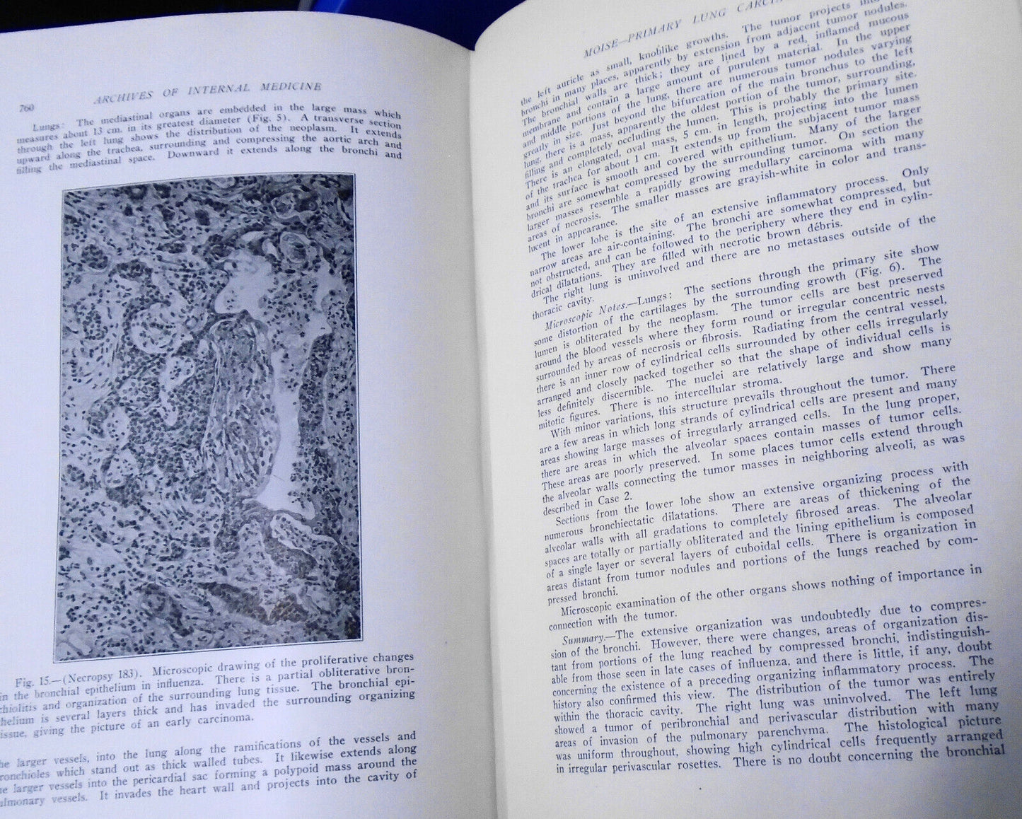 Archives Of Internal Medicine, Volume 28, 1921. American Medical Association.