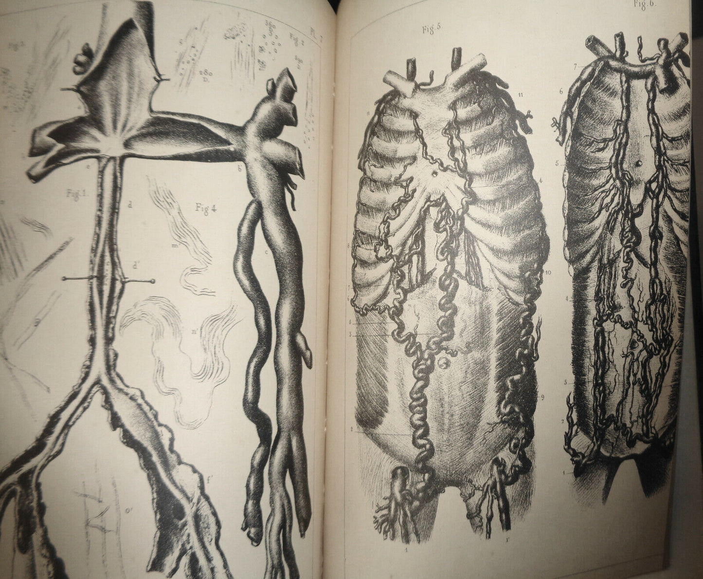 1861 COMPTES RENDUS DES SEANCES ET MEMOIRES DE LA SOCIETE DE BIOLOGIE Ser 3 T3