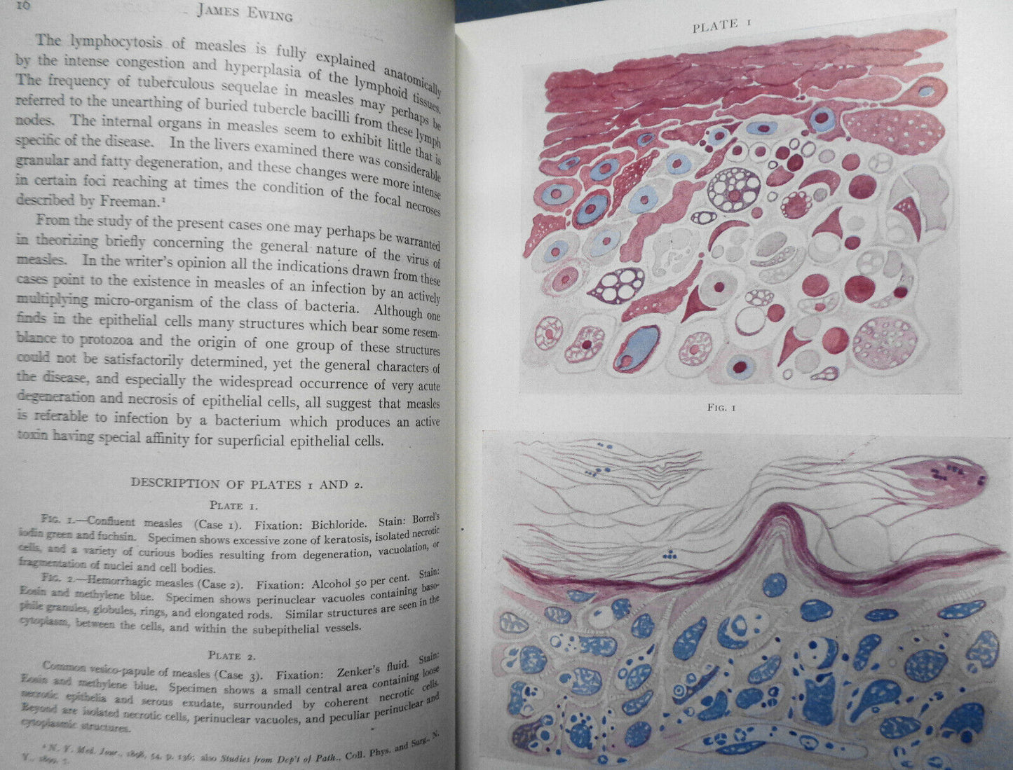 The Journal of Infectious Diseases. Volume 6, 1909. Original.