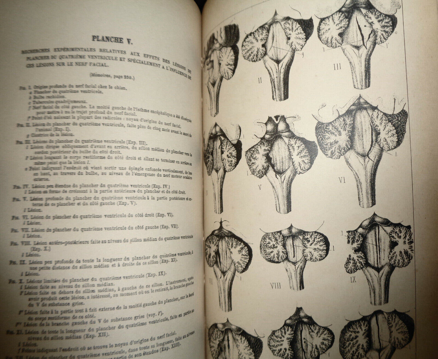 1861 COMPTES RENDUS DES SEANCES ET MEMOIRES DE LA SOCIETE DE BIOLOGIE Ser 3 T3