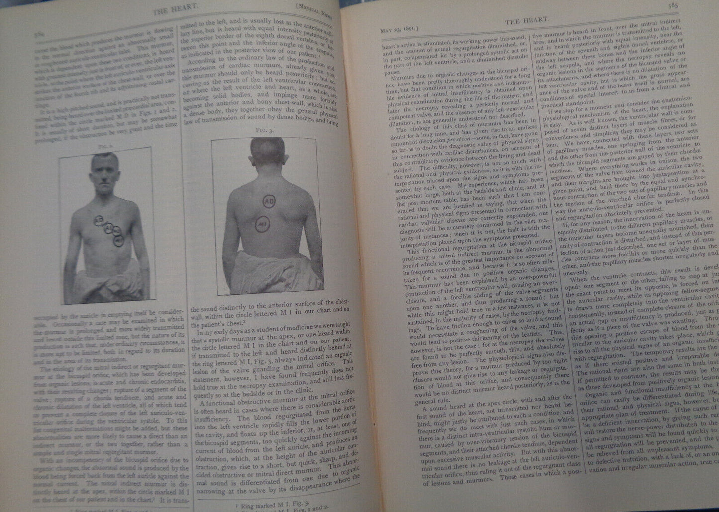 THE MEDICAL NEWS : VOL. 58, JAN.-JUNE, 1891 A WEEKLY MEDICAL JOURNAL