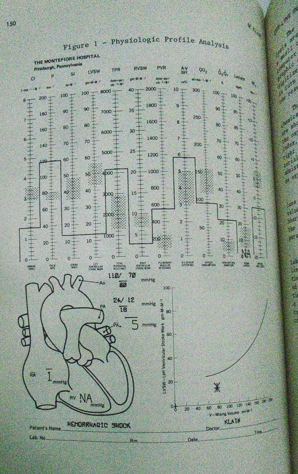 Computers in critical care and pulmonary medicine, by Sreedhar Nair. 1st ed 1980