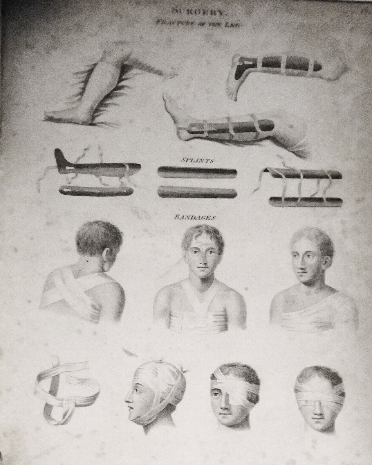 [1815] Surgery tools - 12 engraved plates from Rees' Cyclopaedia plus article