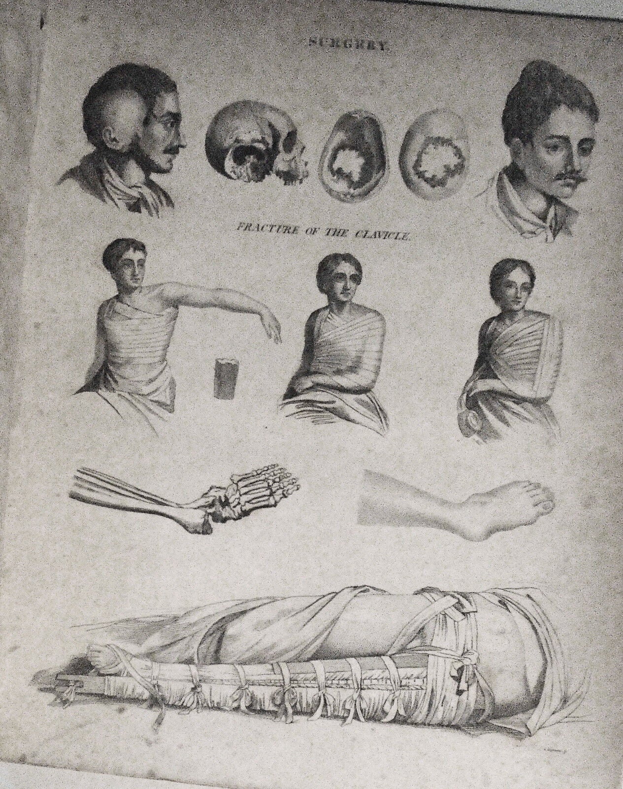 [1815] Surgery tools - 12 engraved plates from Rees' Cyclopaedia plus article