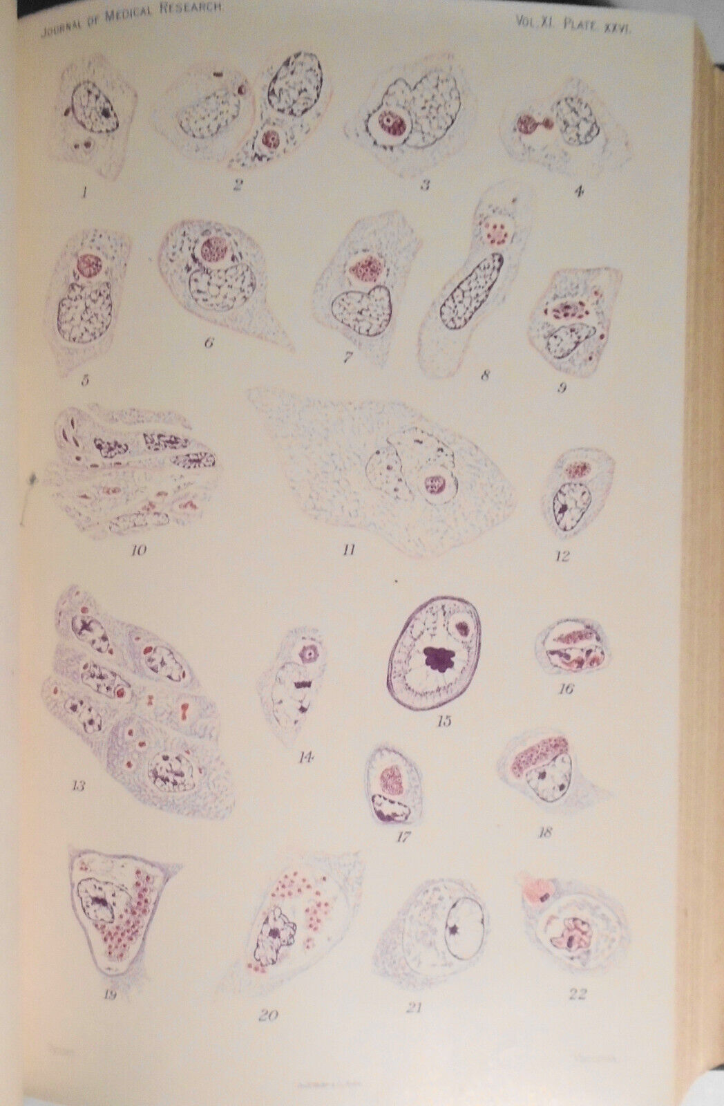 Studies From the Rockefeller Institute for Medical Research - Volume 3, 1905