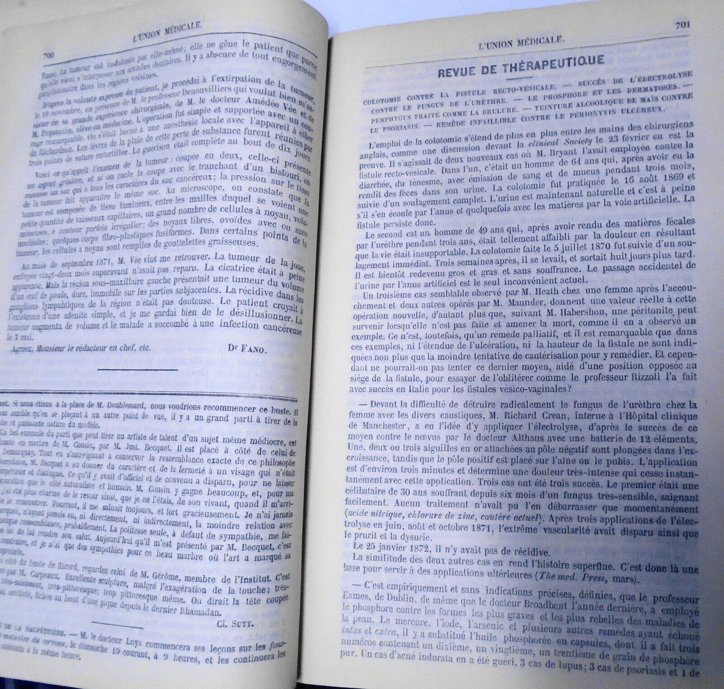 1872 L'union Medicale - Journal Des Interets Scientifique Et Pratiques...Medical