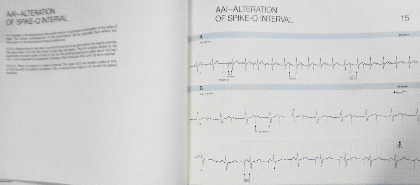 Pacemaker electrocardiograms : an introduction to practical analysis - SIGNED