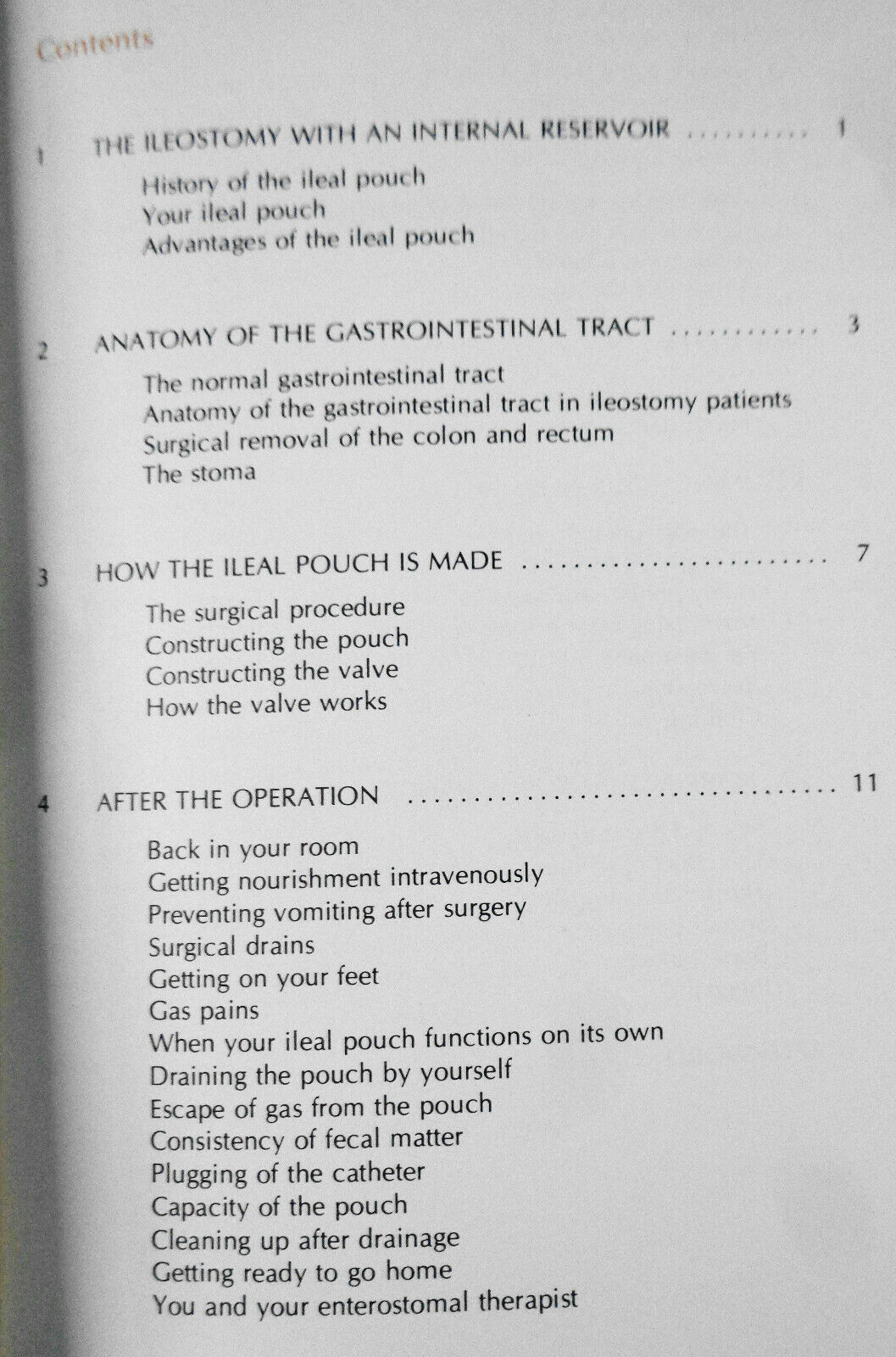 The ileal pouch procedure : a new outlook for the person with an ileostomy 1975