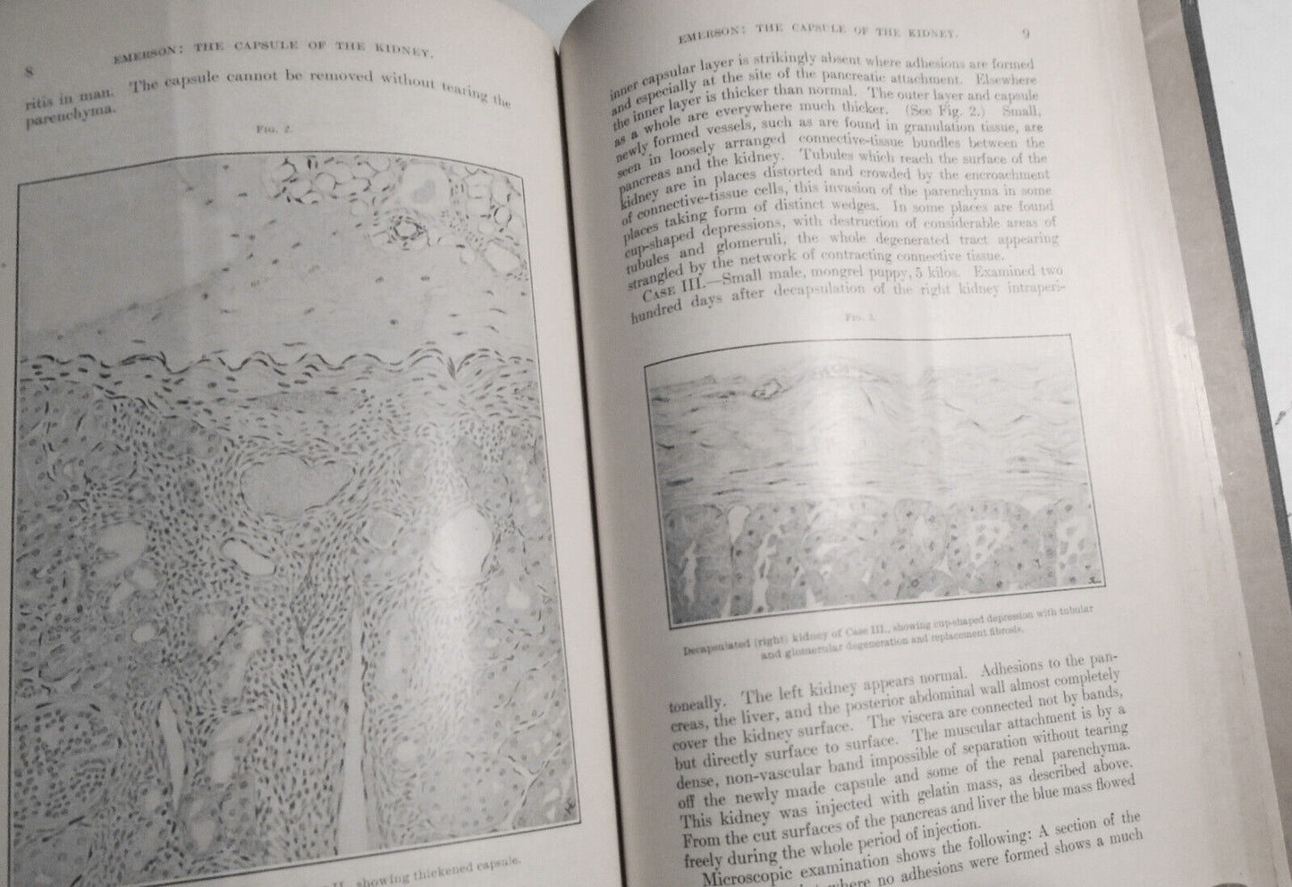 Studies From the Rockefeller Institute for Medical Research - Volume 3, 1905