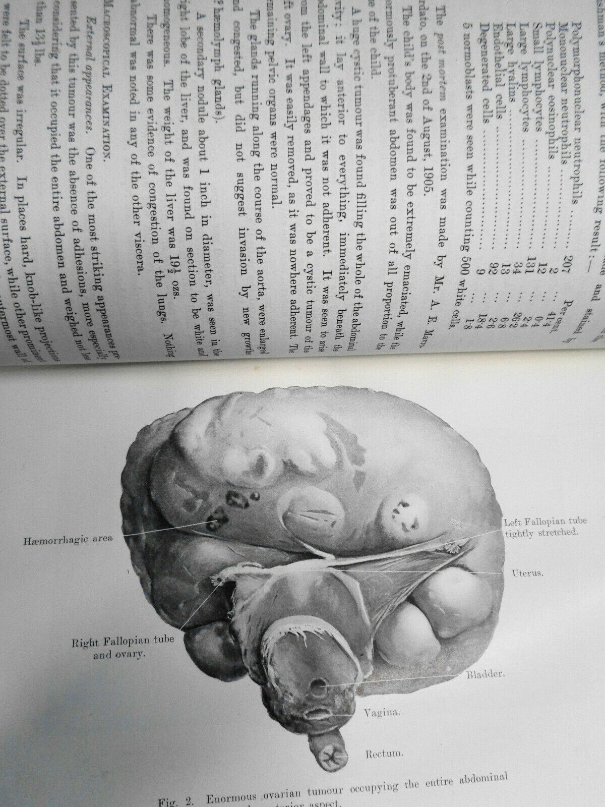 JOURNAL OF OBSTETRICS AND GYNAECOLOGY  - VOL. IX. JAN TO JUNE, 1906