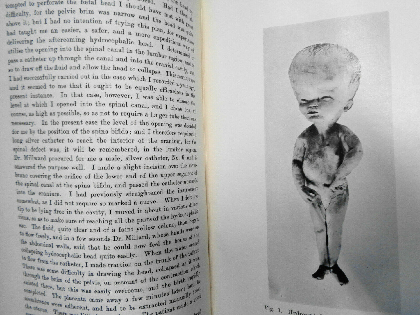 Journal Of Obstetrics And Gynaecology - Vol. IX. Jan To June, 1906